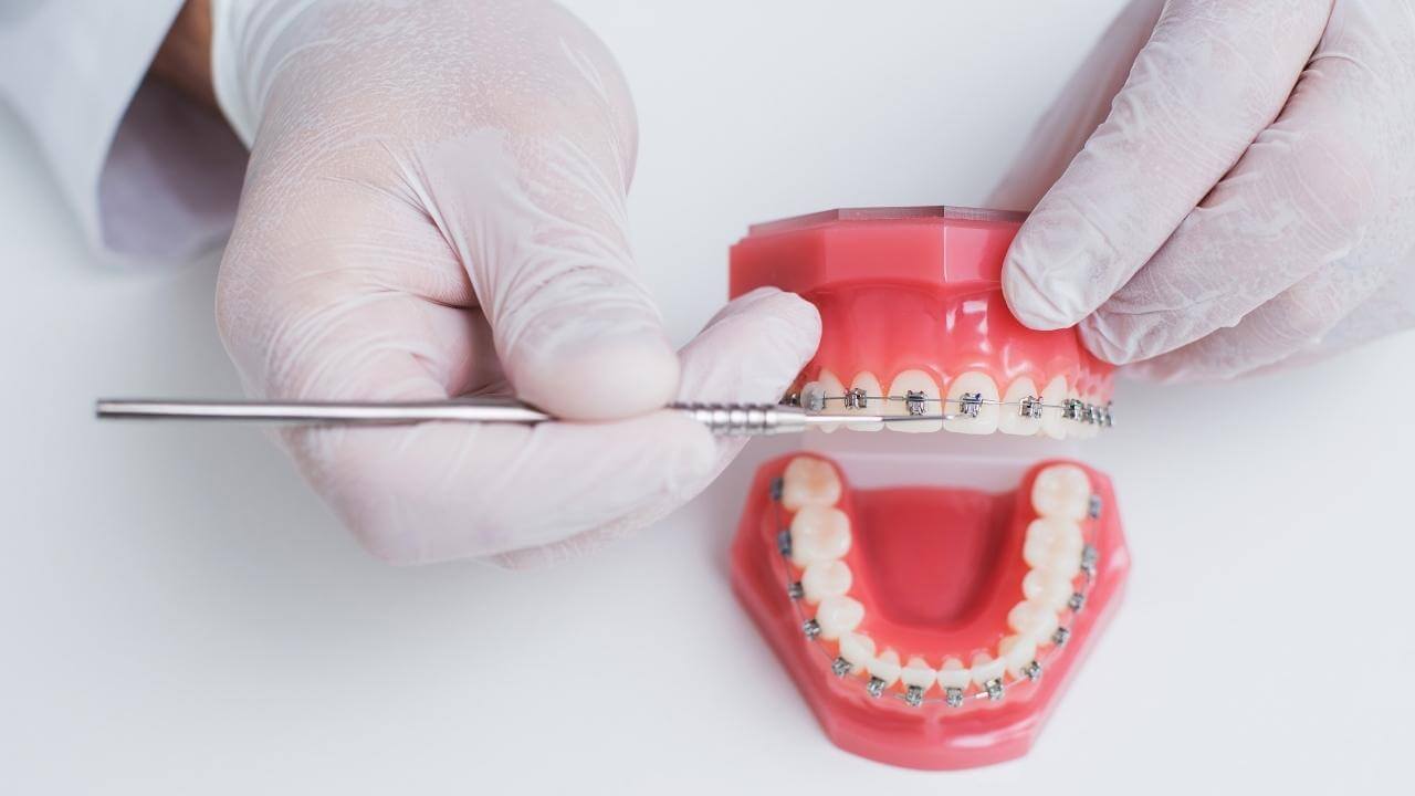 רופא שיניים מדמה טיפול שורש עם גשר
