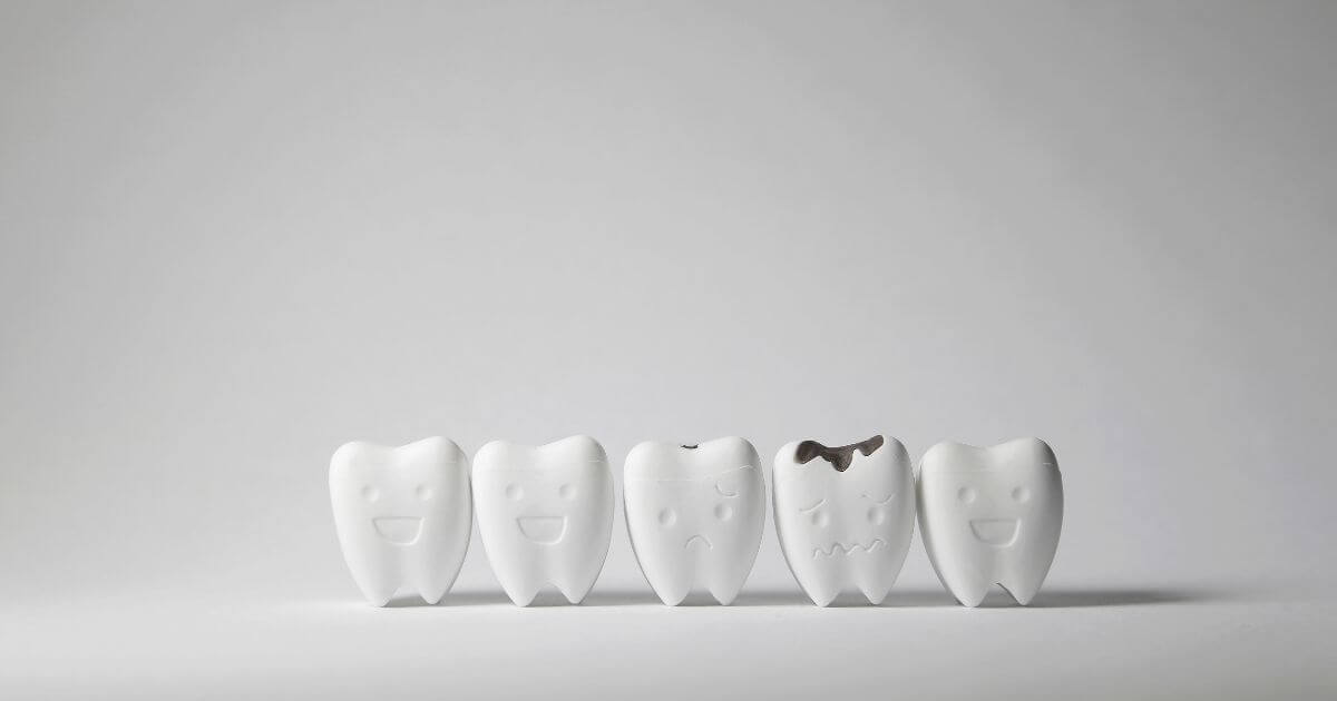 מהי שן נמקית והאם ניתן להצילה בעזרת טיפול שורש?